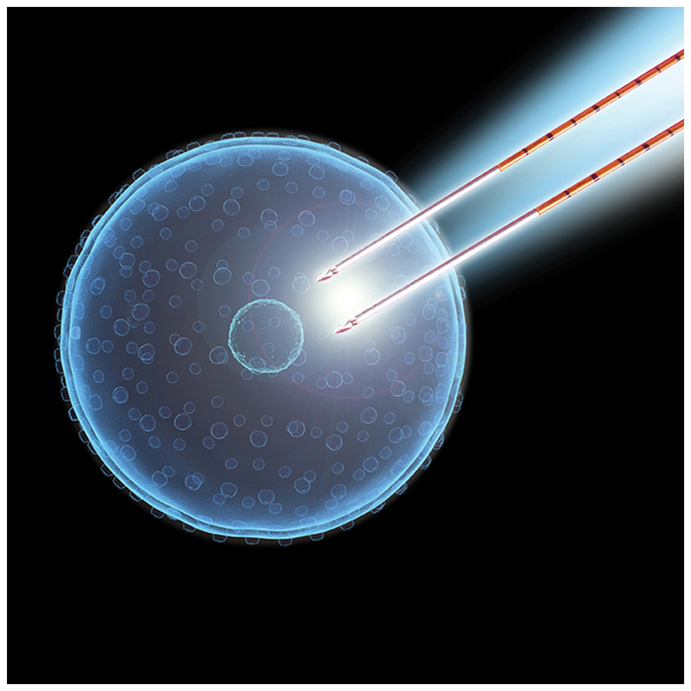 AngioDynamics NanoKnife Irreversible Electroporation (IRE)2.jpg