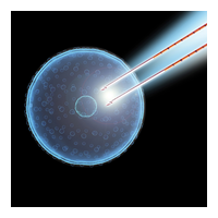 AngioDynamics NanoKnife Irreversible Electroporation (IRE)2.jpg