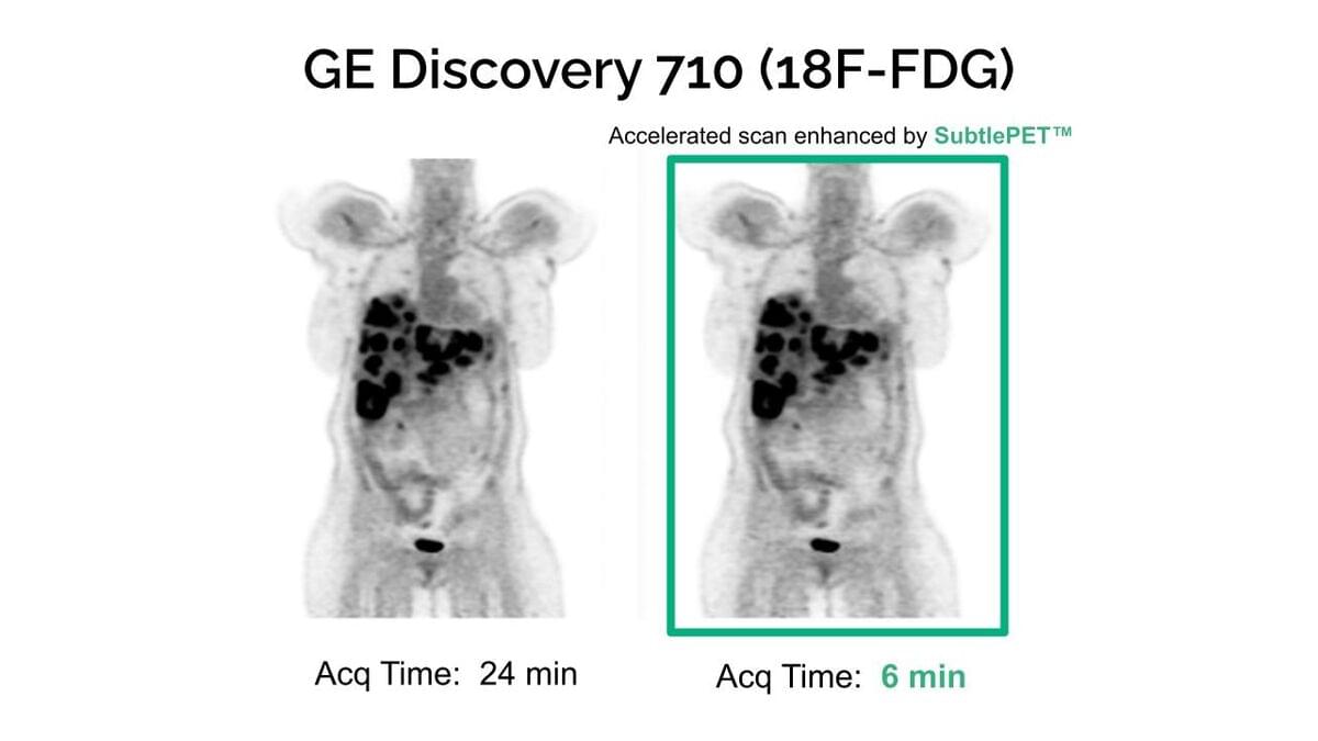 SubtlePET 2.0 Gets CE Mark • APPLIED RADIOLOGY