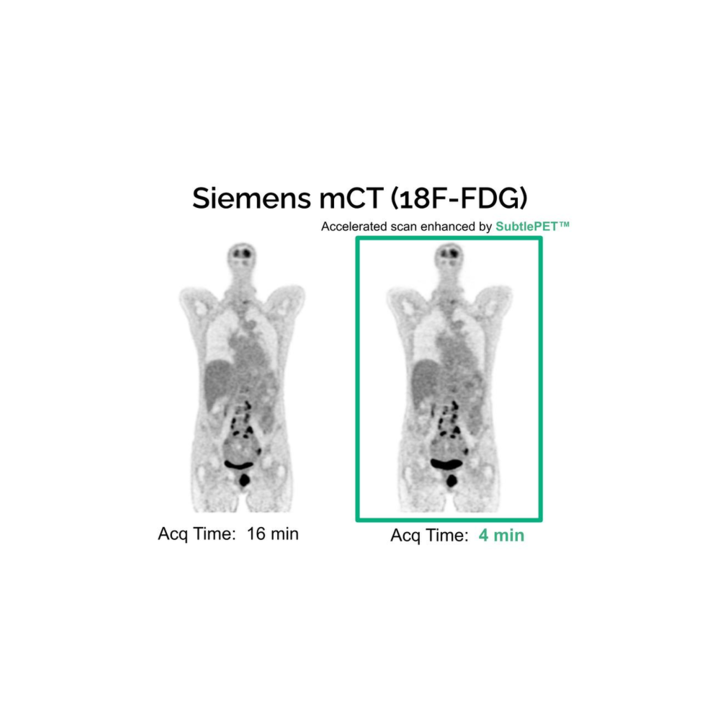 SubtlePET 2.0 Gets CE Mark • APPLIED RADIOLOGY