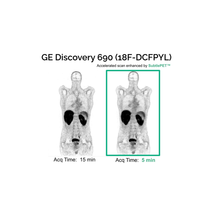 SubtlePET 2.0 Gets CE Mark • APPLIED RADIOLOGY