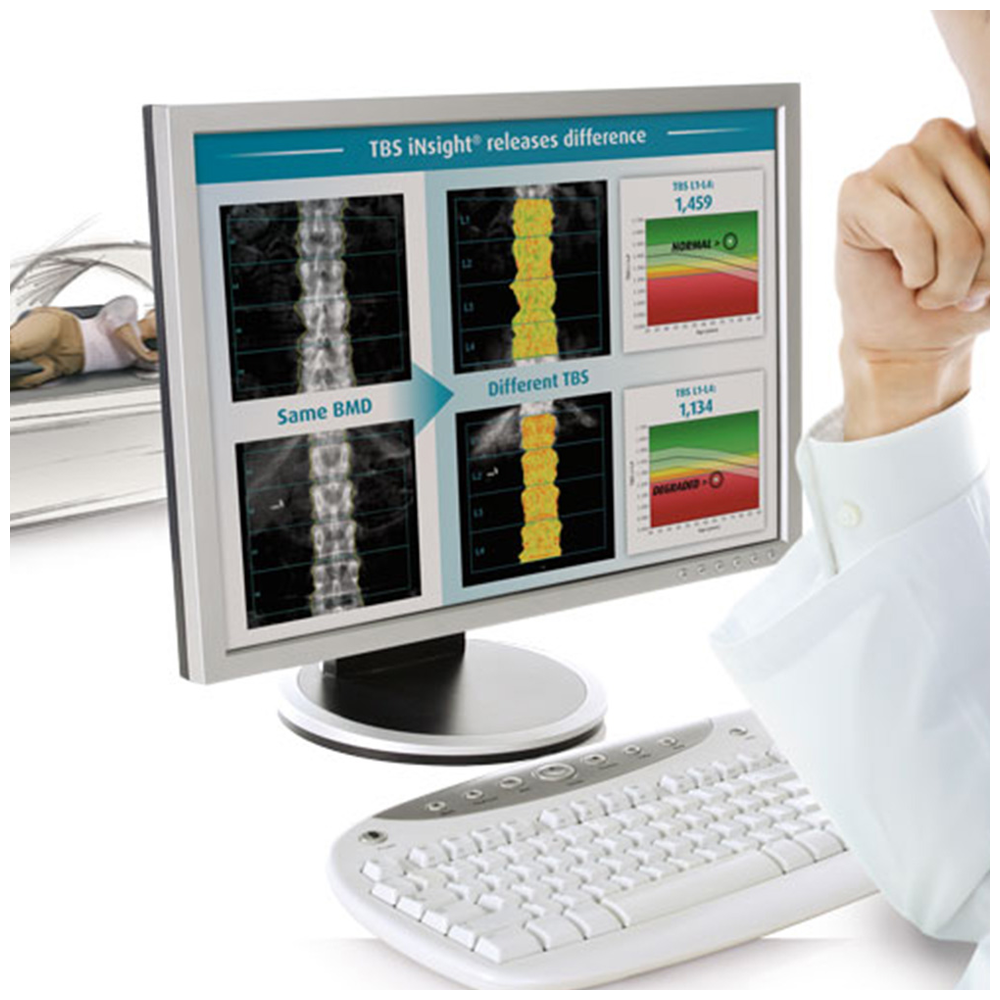 MediMaps TBS iNsight2.jpg