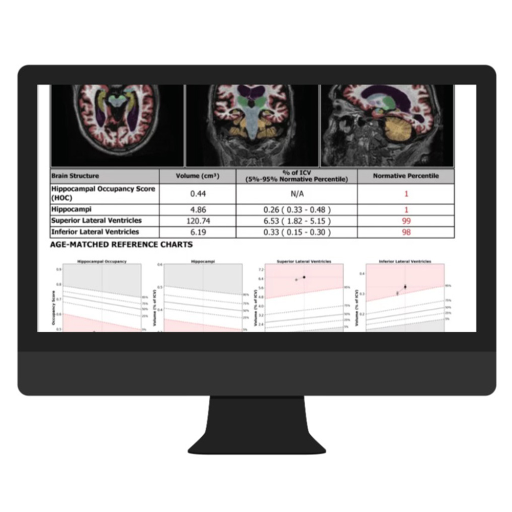 Cortechs-ai NeuroQuant & LesionQuant2.jpg