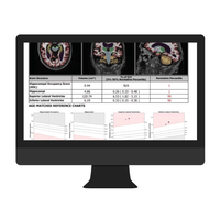Cortechs-ai NeuroQuant & LesionQuant2.jpg