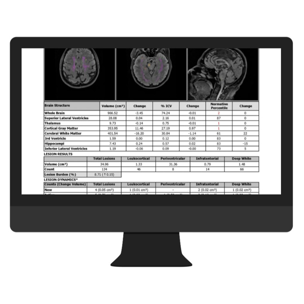 Cortechs-ai NeuroQuant & LesionQuant3.jpg