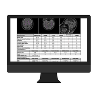 Cortechs-ai NeuroQuant & LesionQuant3.jpg